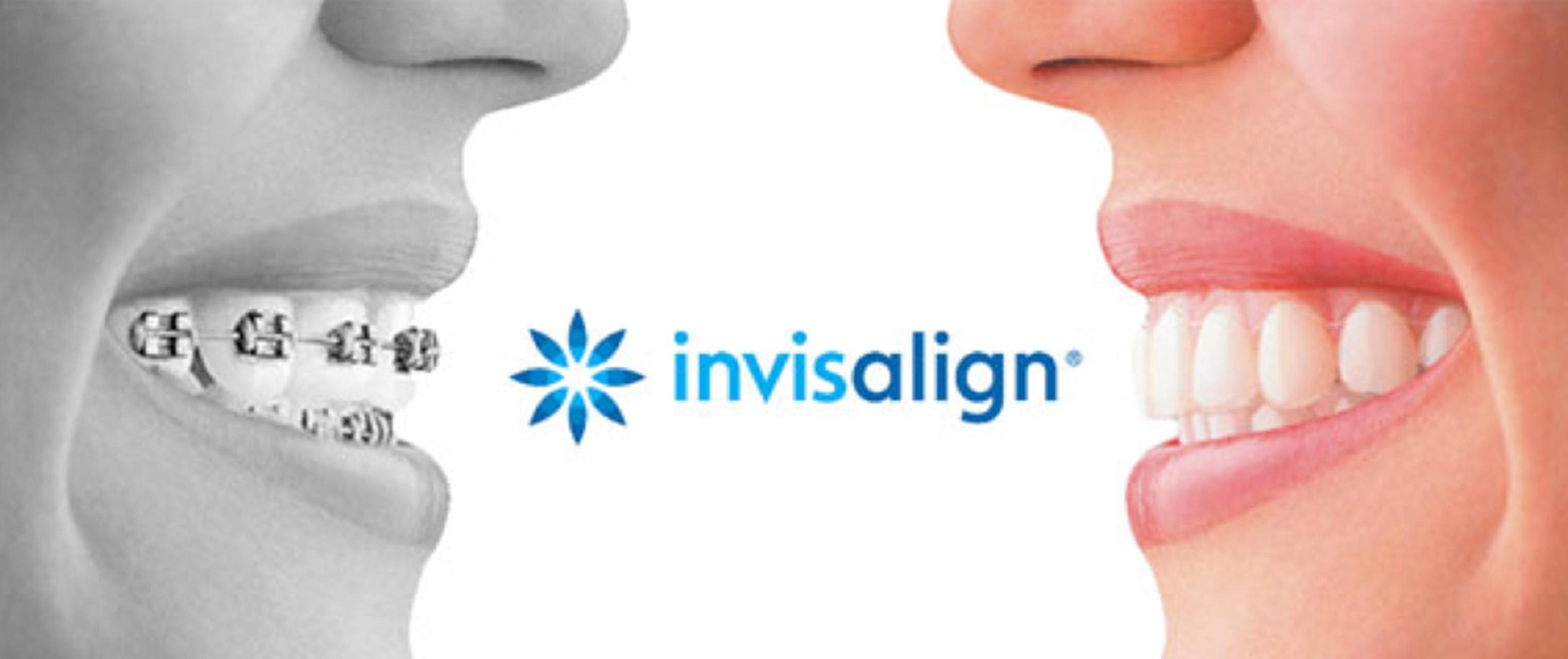 invisalign-treatment-clinic